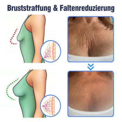 flysmus™ Erweiterte straffende & faltenreduzierende Lotion