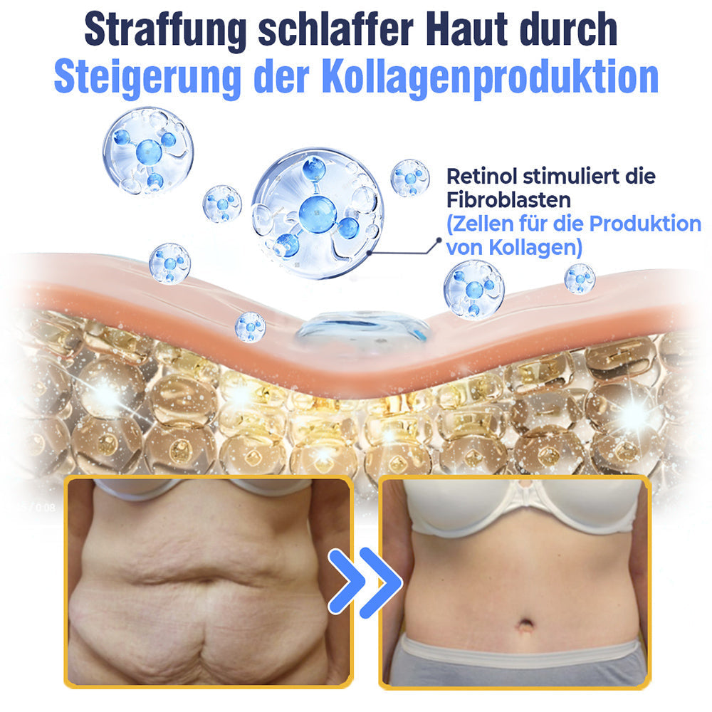 flysmus™ Erweiterte straffende & faltenreduzierende Lotion