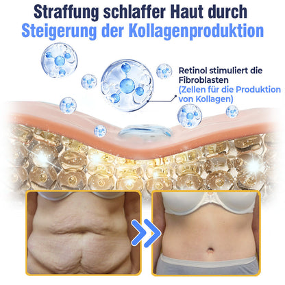 flysmus™ Erweiterte straffende & faltenreduzierende Lotion