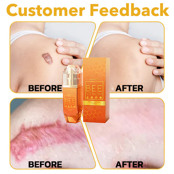 🌿🐝Furzero™ Bienengift Therapie Behandlung Essenz