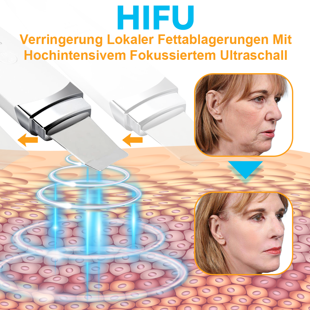 GFOUK™ Hochintensiver Fokussierter Ultraschall Facelifting Gerät