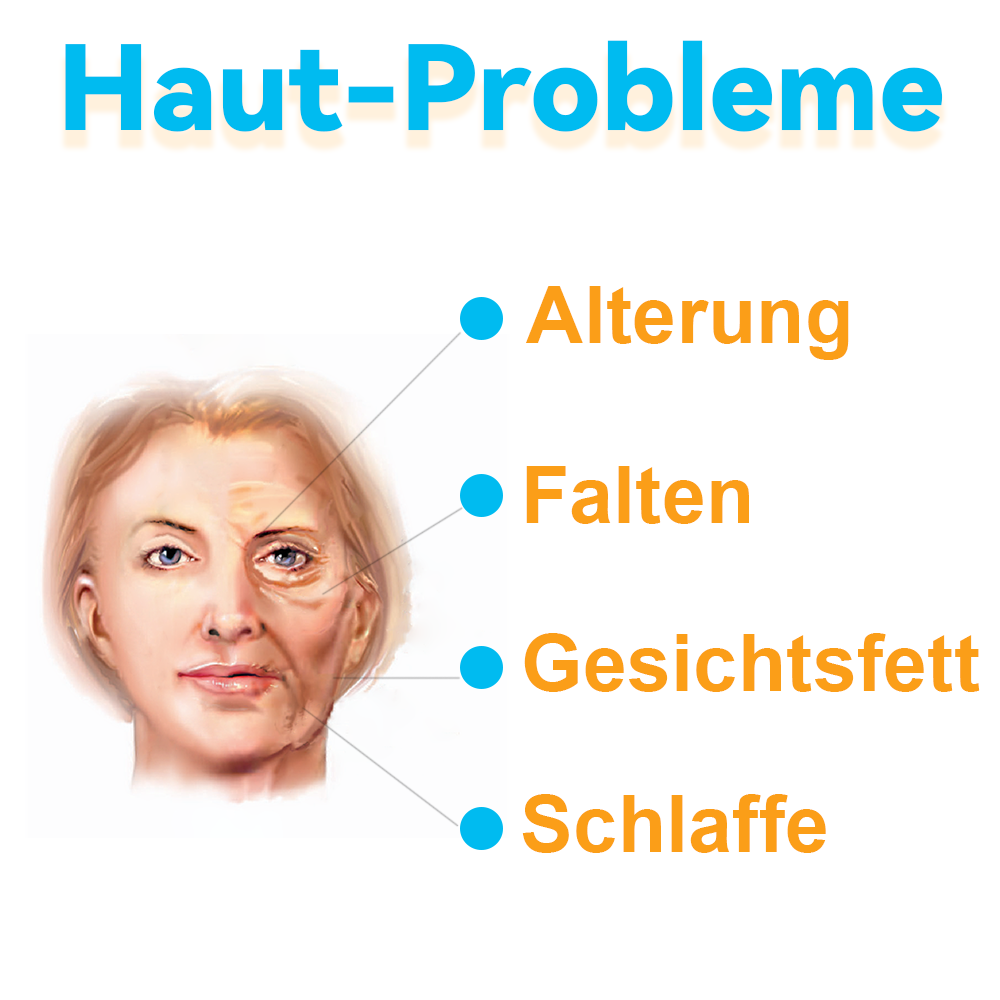 GFOUK™ Hochintensiver Fokussierter Ultraschall Facelifting Gerät