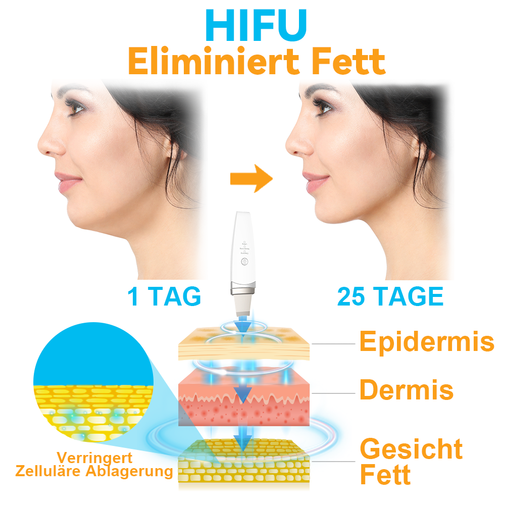 GFOUK™ Hochintensiver Fokussierter Ultraschall Facelifting Gerät