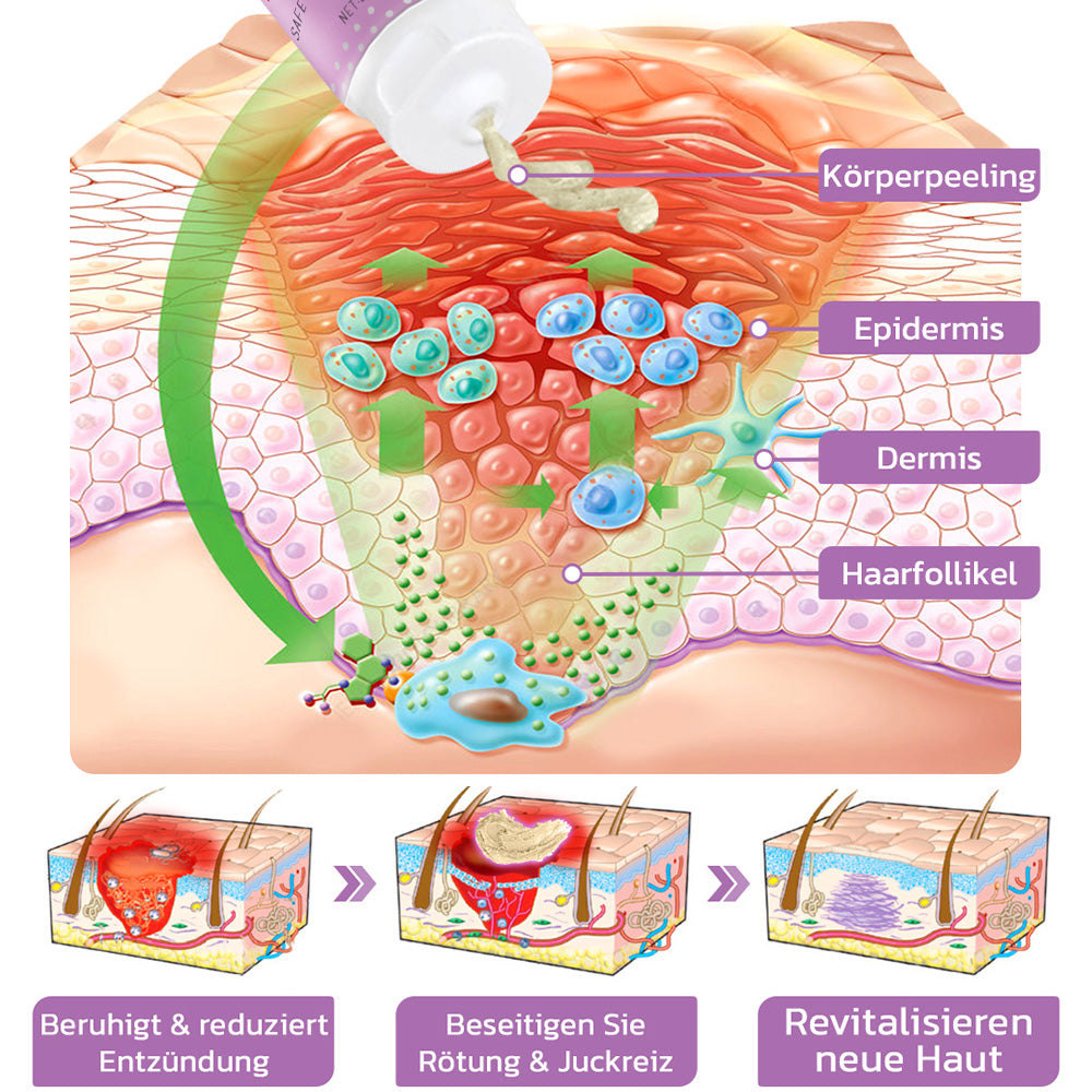 flysmus™ KP Keratose Gleichgewicht Radiergummi Körper Peeling