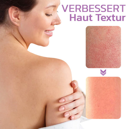 flysmus™ KP Keratose Gleichgewicht Radiergummi Körper Peeling